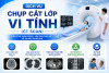 Chụp cắt lớp vi tính (CT SCAN) Nhanh chóng – Chính xác – Hiệu quả