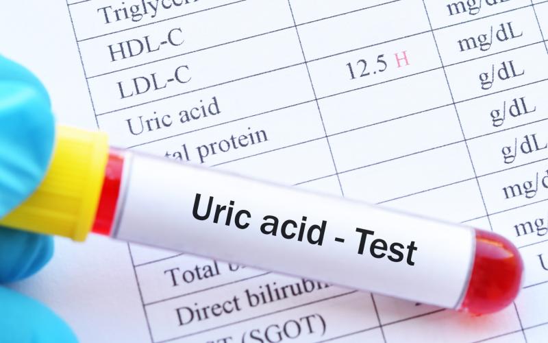 Tăng acid uric có làm suy giảm ‘bản lĩnh’ nam giới?