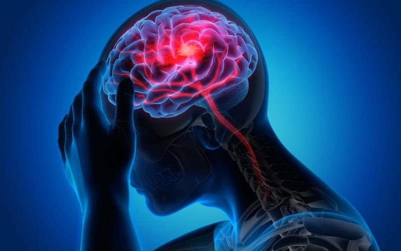 Đau nửa đầu tái diễn, khi nào cần đi khám?