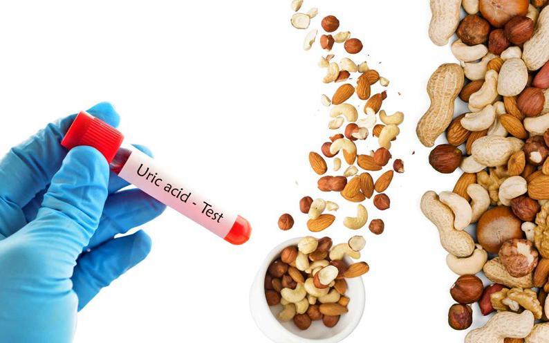 Tăng acid uric máu không chỉ do hải sản mà còn do nhiều thói quen 
