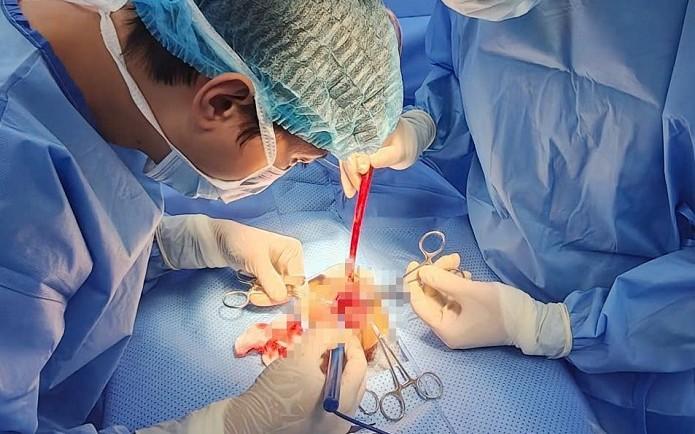 Nam sinh 15 tuổi bị vỡ tinh hoàn, đừng chủ quan với chấn thương vùng bìu