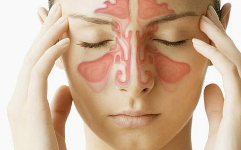 5 yếu tố làm tăng nguy cơ viêm xoang